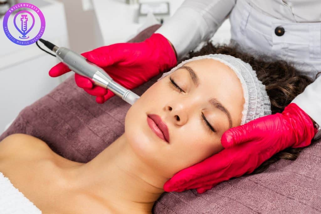 Microneedling – What You Need to Know