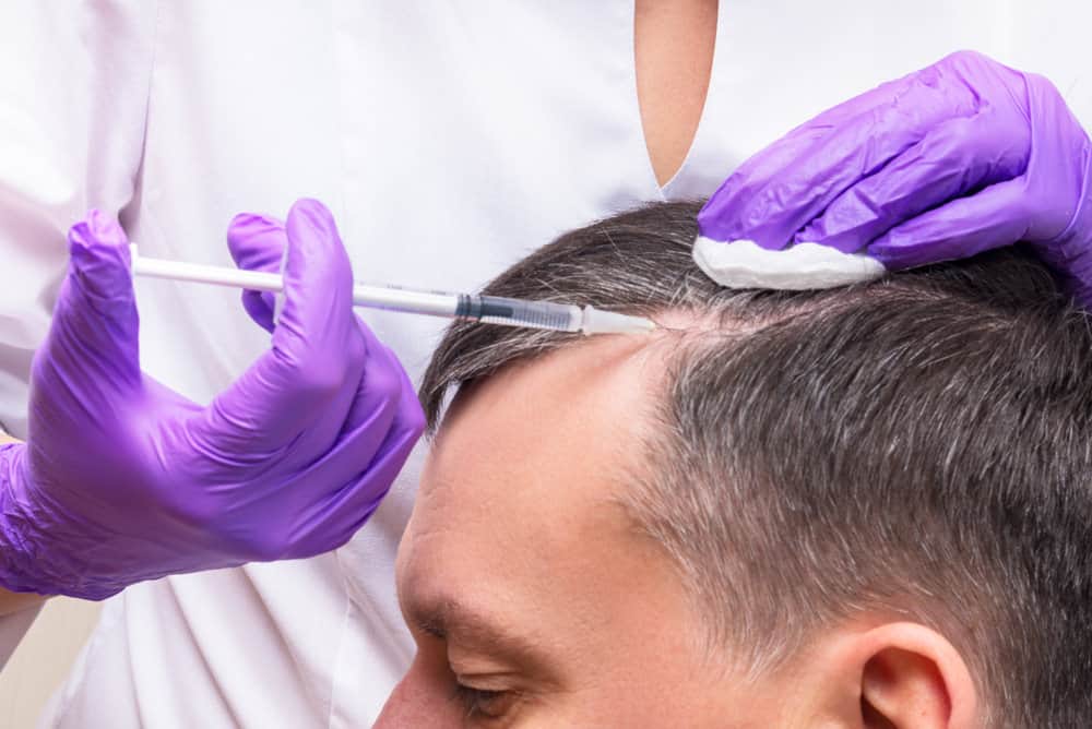 Revitalizing Tresses: The Transformative Benefits of PRP Hair Injections